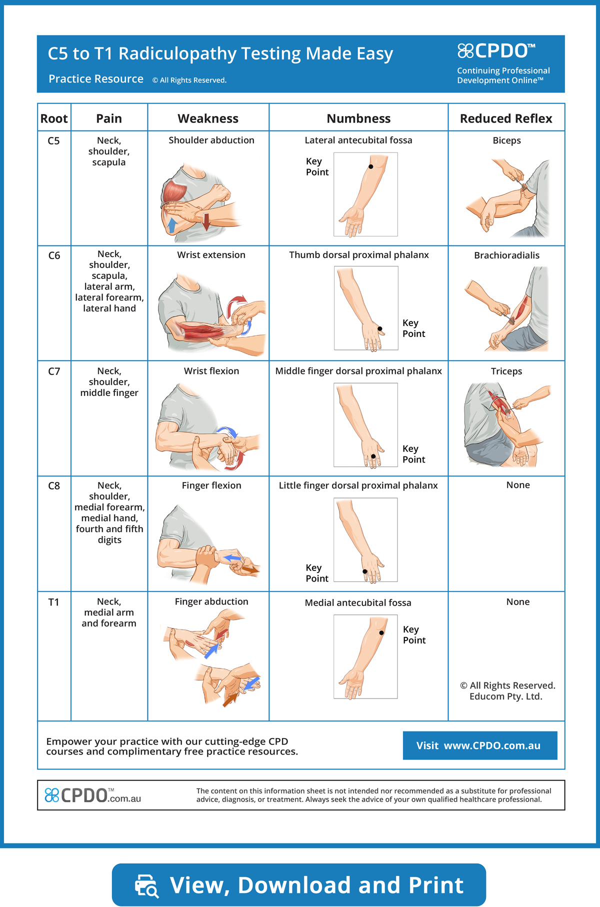 C5 - T1 Radiculopathy Signs and Symptoms